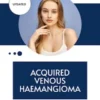 Acquired Venous Haemangioma