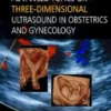 Advanced Topics on Three-Dimensional Ultrasound in Obstetrics and Gynecology