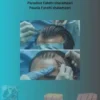 Advancements in Hair Transplantation: A Comprehensive Guide to Techniques and Management
