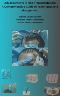 Advancements in Hair Transplantation: A Comprehensive Guide to Techniques and Management