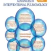Advances in Interventional Pulmonology