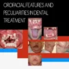 Craniofacial Disorders – Orofacial Features and Peculiarities in Dental Treatment