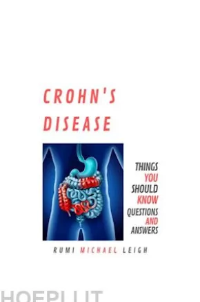 Crohn's disease