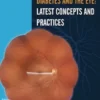 Diabetes and the Eye: Latest Concepts and Practices