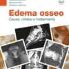 Edema osseo