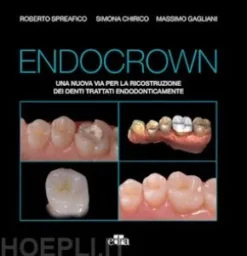 Endocrown