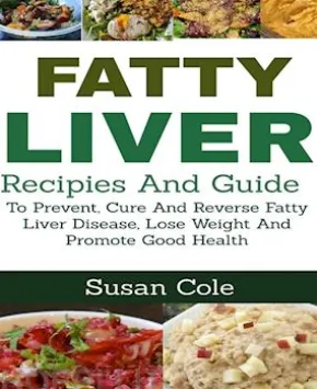 Fatty Liver