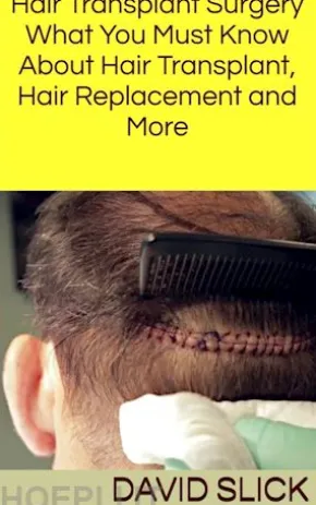 Hair Transplant Surgery