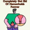 How to Completely Get Rid Of Hemorrhoids Forever