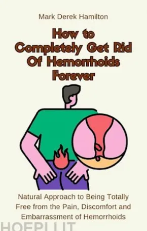 How to Completely Get Rid Of Hemorrhoids Forever