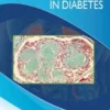 Kidney Disease in Diabetes