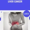 Liver Cancer