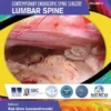 Lumbar Spine