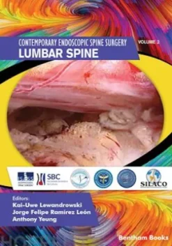 Lumbar Spine