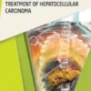 Nanotherapeutics for the Treatment of Hepatocellular Carcinoma