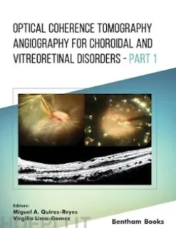 Optical Coherence Tomography Angiography for Choroidal and Vitreoretinal Disorders – Part 1