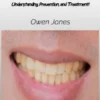 Stained Teeth