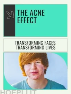 The Acne Effect