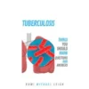 Tuberculosis