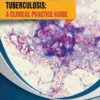 Tuberculosis: A Clinical Practice Guide